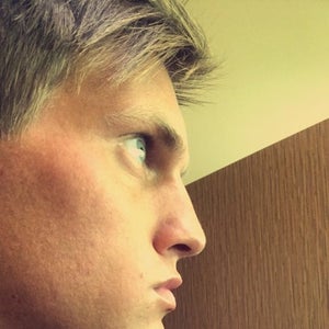 How Long Does It Take For Sculptra To Work - However, it may take up to 12 weeks or longer for a noticeable improvement.