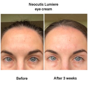 neocutis eye cream before and after