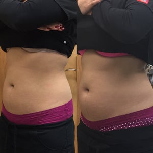Trusculpt 3d Reviews Was It Worth It Realself