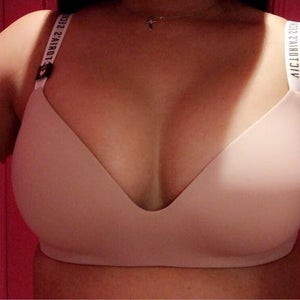 Will my boobs get bigger as they drop? I had my BA almost 3 weeks ago.  (Photos)