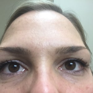 crepey under eye treatment