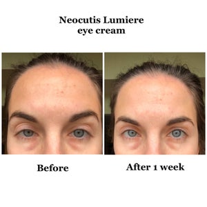 neocutis eye cream before and after