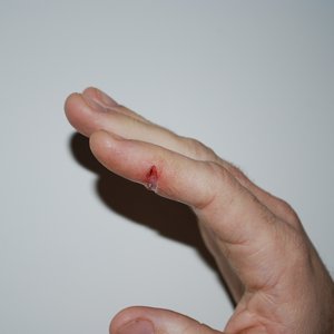 Minor Cut Finger