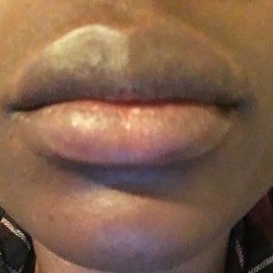 Cupid's Bow Lips Are the Newest Trend in Fillers - James Christian New  York's Injectable Expert