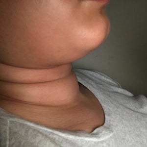 Neck with outlet rolls