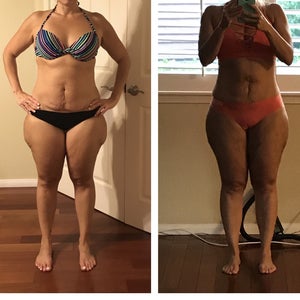 Will lipo results get better? Not much difference and weird indentation.  (Photo)