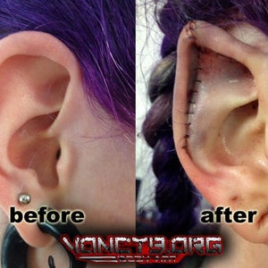 Body Modification Elf Ears Cost Conch Removal Ear Surgery Comes With Body Modification Elf Ears Cost Conch Removal Ear Surgery Comes With