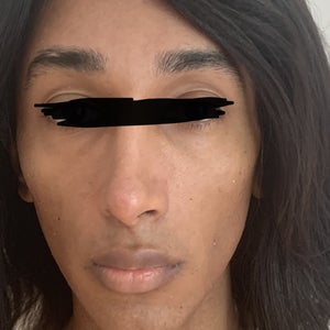 before and after