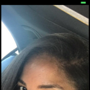 permanent solution for under eye hollows