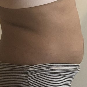 Tickle Lipo Reviews Was It Worth It Realself