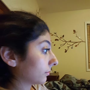 Is There A Way To Tell If A Nose Has Been Broken Before Photo