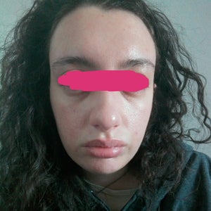 before and after