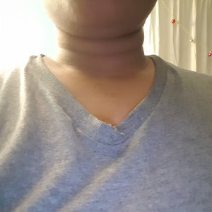 How to get rid of neck fat lines deals