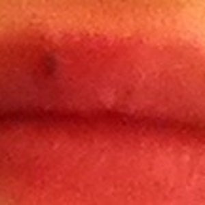 I have a brown spot on lip that I like to remove. Any suggestions? (photos)