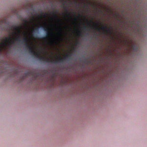 get rid of lines under eyes