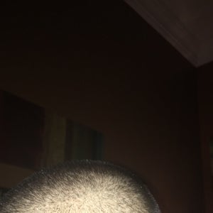 Could I Have Lost My Hair Permanently From Using A Derma Roller On My Hair Photo