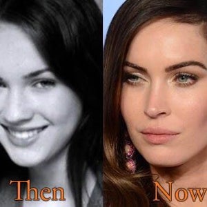 Can Button Noses Achieve A Megan Fox Type Rhinoplasty Photos Talking about megan fox nose job go on climbing as the renowned transformers star attended a video music award occasion offered by mtv. can button noses achieve a megan fox