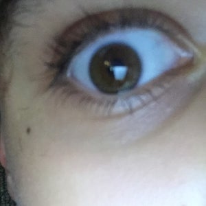 wrinkles under eyes at 15