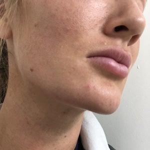before and after