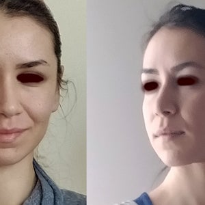 before and after
