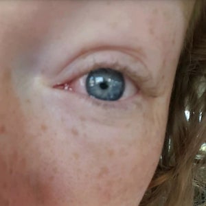 fine lines under eyes at 23