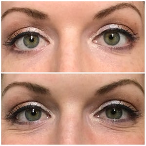 crepey under eye treatment