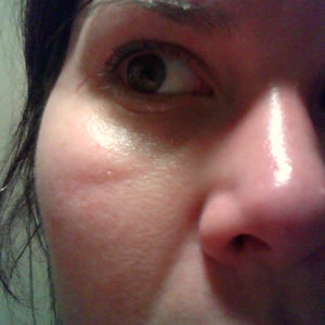 huge lines under eyes