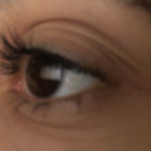 wrinkly eyelids at 18