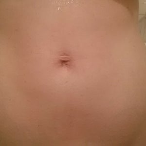 Loose skin after pregnancy: Pictures, treatments, and timeline