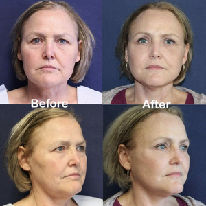 Brian Windle Plastic Surgery (closed)