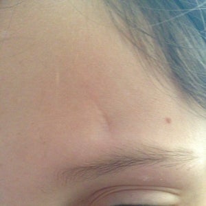 face dent removal cream