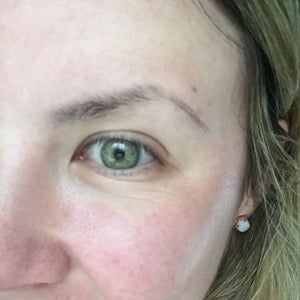 static wrinkles under eyes