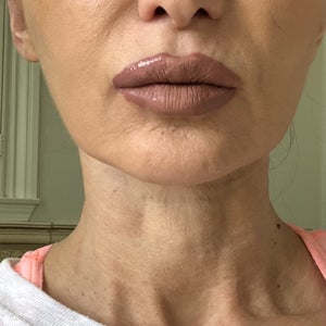 before and after