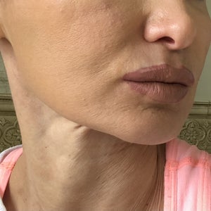 before and after
