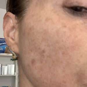 before and after