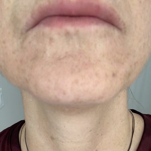 before and after