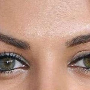 Surgery to change eye shape to cat/almond and costs? (photos)