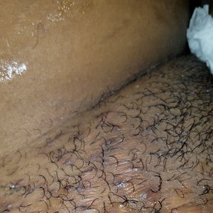 Green Stitches After Surgery What Is This Photo