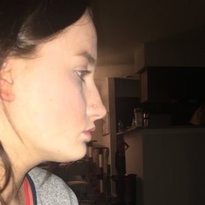 I am not sure what&rsquo;s making my side profile so ugly. (Photos)