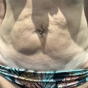 melanotan 2 reconstitution calculator Dr. Johnson