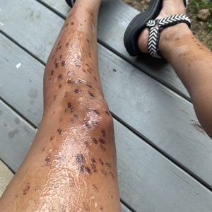 Hair removal hot sale reviews