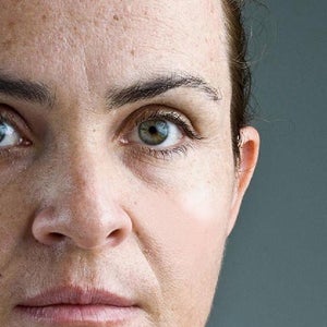 garnier men acno fight acne fighting whitening serum cream