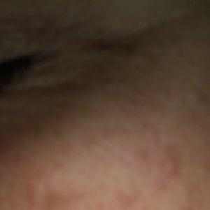 Adern sichtbar brust