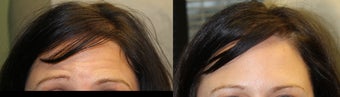 before and after image