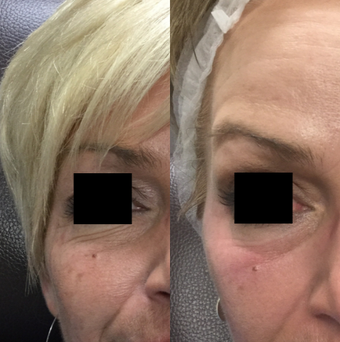 before and after image