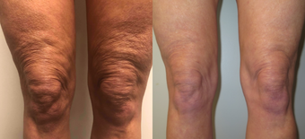 before and after image