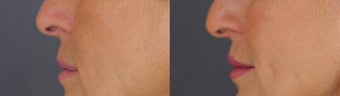 before and after image