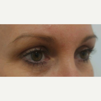 Microblading Costs Safety And Eyebrow Aftercare Tips Realself