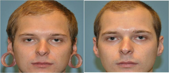before and after image