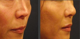 before and after image